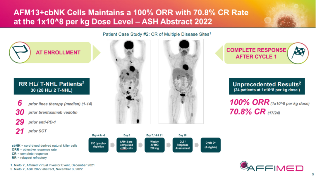 超 2000 项研究从肿瘤到常见病，NK 细胞疗法大有可为