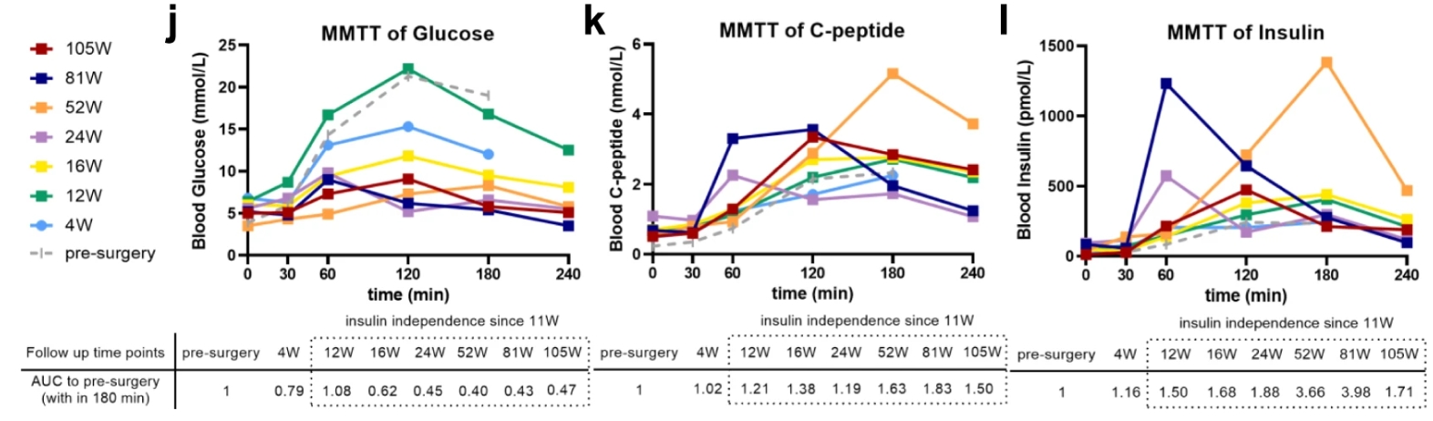 上海长征医院完成世界首例，干细胞治疗 2 型糖尿病，3 月停掉胰岛素，12 月停掉阿卡波糖，14 月停掉二甲双胍