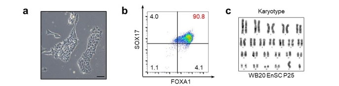 上海长征医院完成世界首例，干细胞治疗 2 型糖尿病，3 月停掉胰岛素，12 月停掉阿卡波糖，14 月停掉二甲双胍
