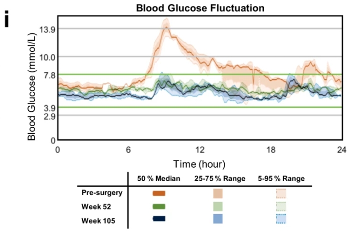 上海长征医院完成世界首例，干细胞治疗 2 型糖尿病，3 月停掉胰岛素，12 月停掉阿卡波糖，14 月停掉二甲双胍