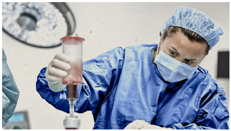 类风湿关节炎的干细胞疗法